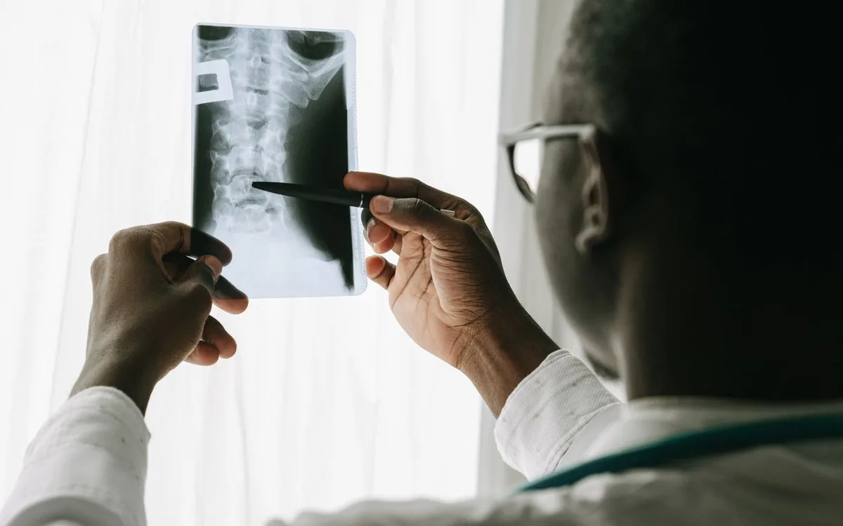 A healthcare professional points to a neck X-ray film with a pen.